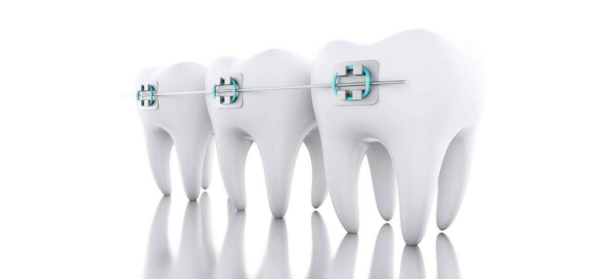 Ортодонтия