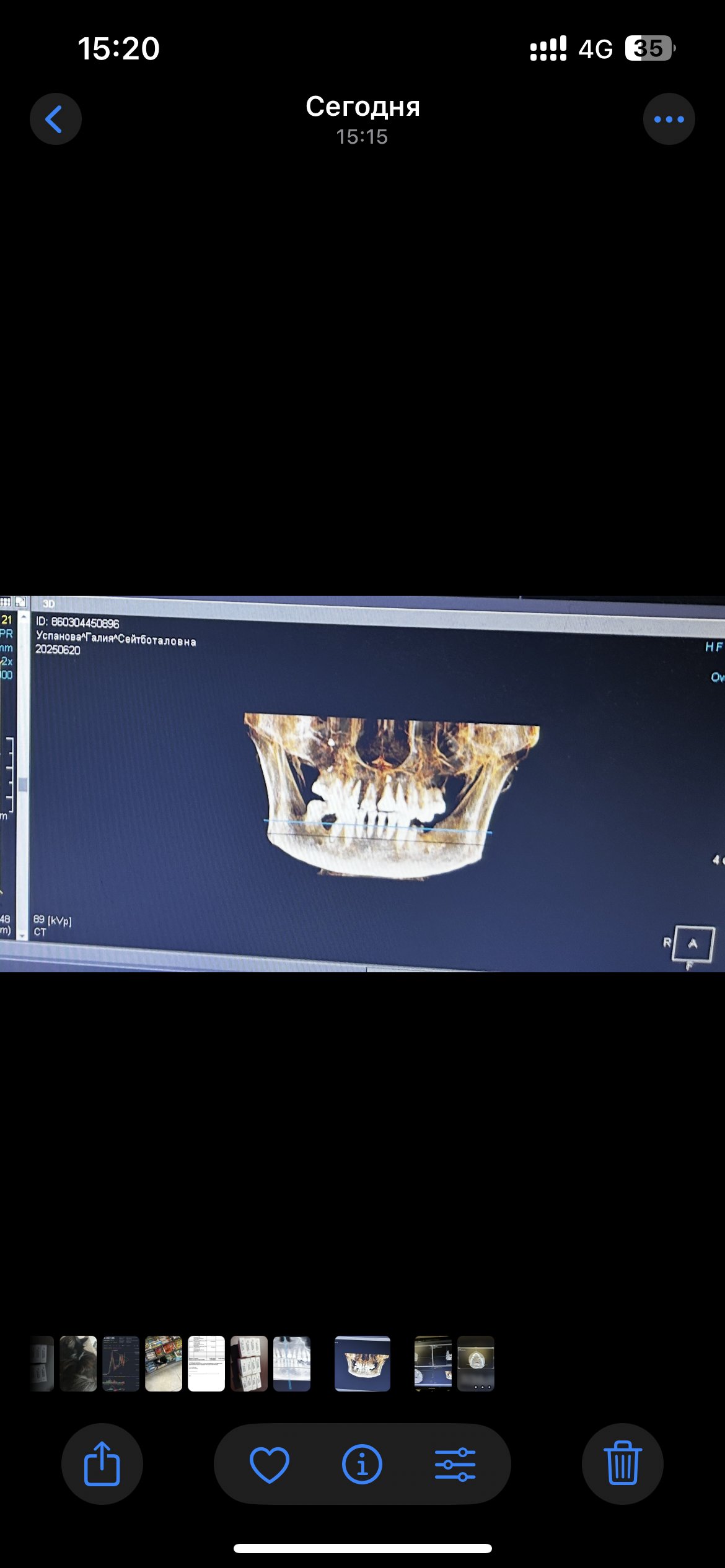 Фото кейса 1