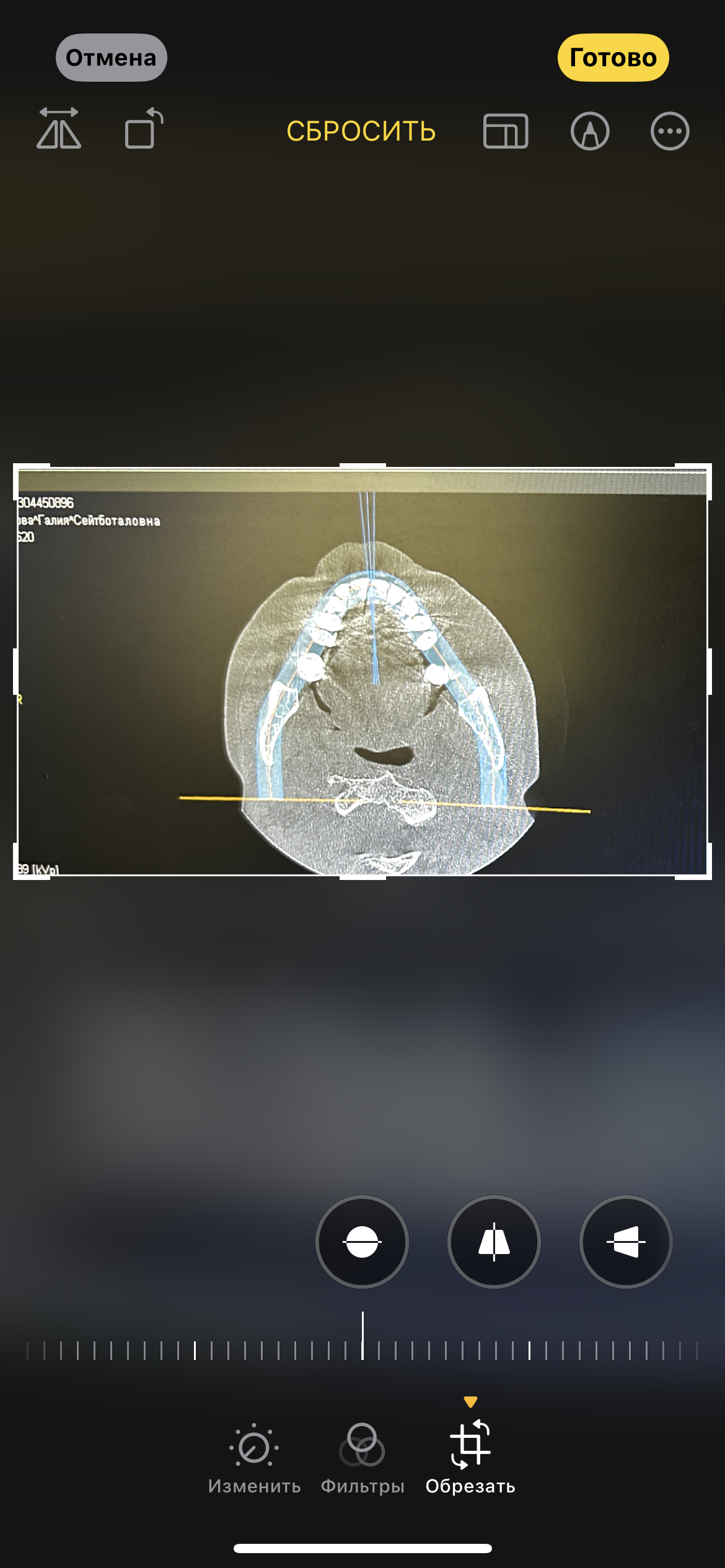 Фото кейса 1