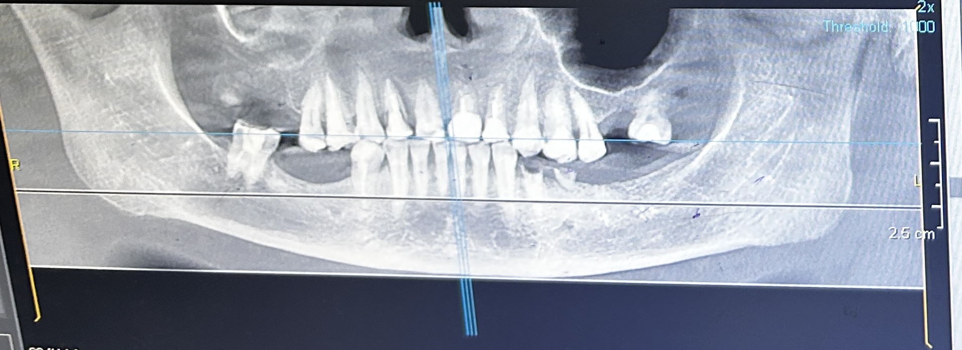 Фото кейса 1